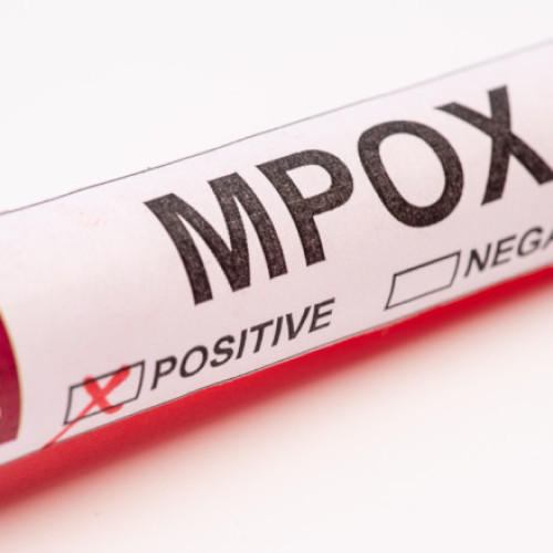 Macedonia de Nord confirmă primele cazuri de infectare cu mpox