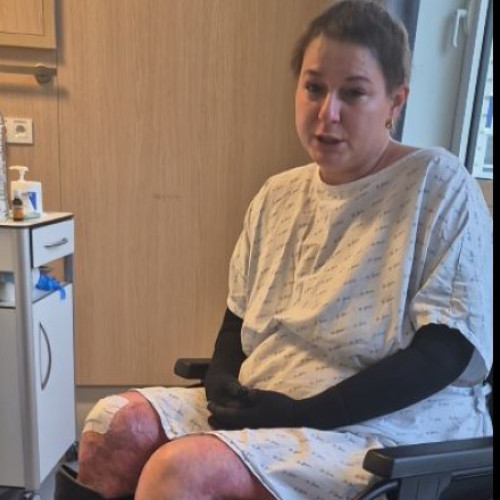 Lavinia Vlad va fi externată după tratamentul pentru arsuri severe în Belgia